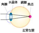 正常な眼